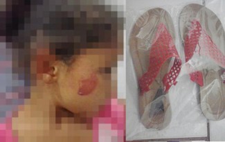 Mãe acerta sandália no rosto de criança e é denunciada pelo ex-marido no interior de MS