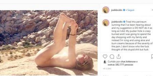 Josh Brilin diz que técnica de banho de sol na genitália o deixou com queimadura - Foto: Reprodução/Instagram