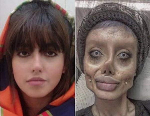 Sahar Tabar antes e depois de 'virar' Angelina Jolie - Foto: Reprodução/Instagram(Sahar Tabar)