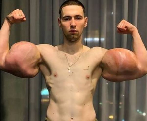 Kirill Tereshin, de 22 anos, mais conhecido como 'Popeye' russo - Foto: Reprodução/Instagram