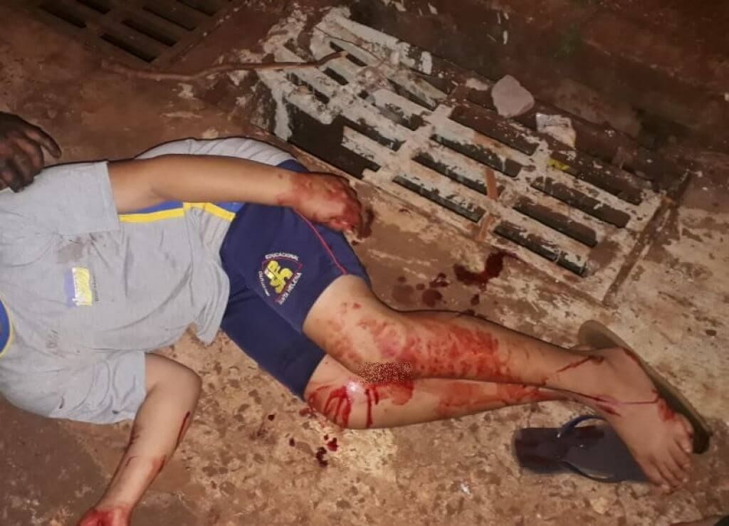 O menino levou 10 pontos no joelho (Foto: divulgação/94FM)