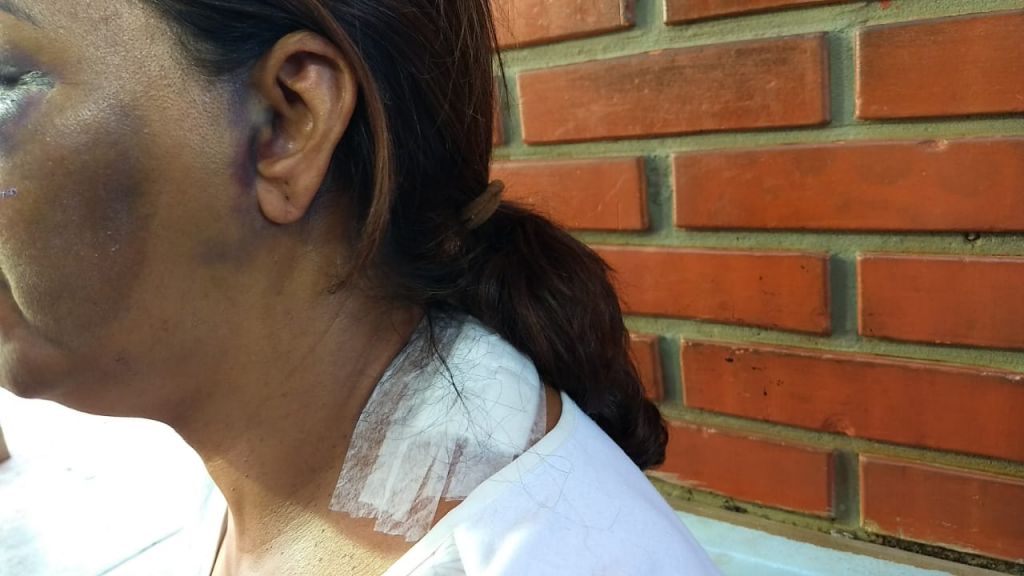 Mulher de 60 anos agredida pelo assaltante - foto: divulgação 