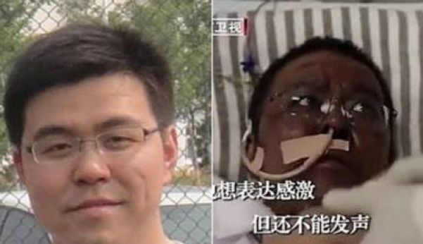 Hu Weifeng antes e depois do coronavírus - Foto: Reprodução/Twitter