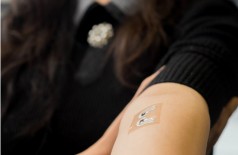 Pesquisadores desenvolvem tatuagem temporária para medir glicose