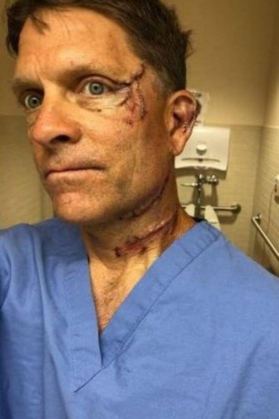 Dave Chernosky ferido após ataque de urso - Foto: Reprodução