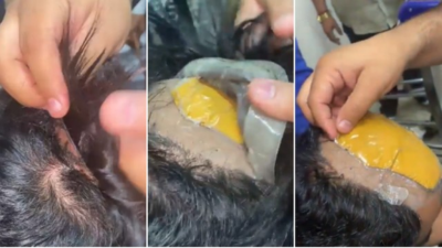 Suspeito foi preso com ouro escondido debaixo da peruca na Índia (Foto: Reprodução)