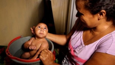 Bebê que ficou conhecido por foto de banho há um ano foi internado com pneumonia em Pernambuco ((Foto: BBC Brasil))