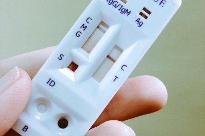 Testes rápidos estarão disponíveis em unidades da rede pública de saúde - Foto: Divulgação