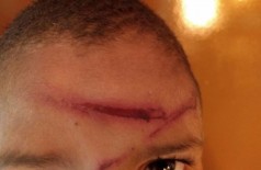 Criança ficou com ferimentos graves após a agressão da mãe; (Fotos: Osvaldo Duarte)