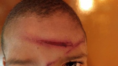 Criança ficou com ferimentos graves após a agressão da mãe; (Fotos: Osvaldo Duarte)