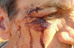 Sitiante de 58 anos sofreu ferimento na cabeça durante confronto com índios (Foto: Adilson Domingos)