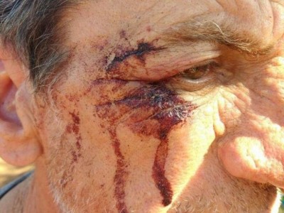 Sitiante de 58 anos sofreu ferimento na cabeça durante confronto com índios (Foto: Adilson Domingos)