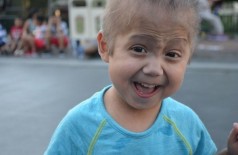 Enzo, de 6 anos, tem uma condição genética rara que o faz envelhecer antes da hora (Foto: Reprodução/Team Enzo Progeria)