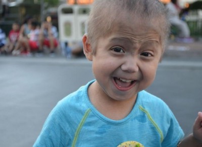 Enzo, de 6 anos, tem uma condição genética rara que o faz envelhecer antes da hora (Foto: Reprodução/Team Enzo Progeria)