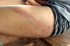 Vítima mostra marcas das agressões provocadas pelo ex-companheiro (Foto: Direto das Ruas)
