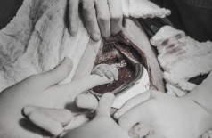 A pequena Luana segurando a mão da obstetra antes mesmo de nascer (Foto: Bruna Costa)