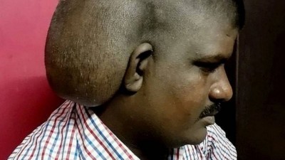 Tumor cerebral em indiano de 31 anos Foto: Reprodução/Twitter