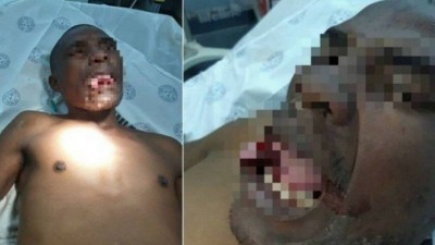 Agressor perde parte da língua ao beijar médica à força (Foto: Reprodução)
