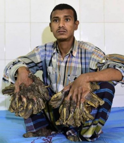 Abul Bajandar Foto: AFP