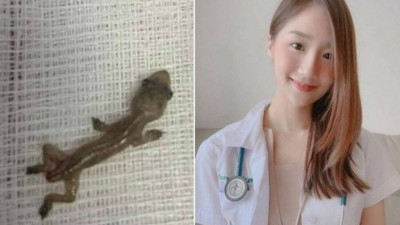 Lagartixa retirada pela médica Varanya Nganthavee (à direita) Foto: Reprodução/Facebook(Varanya Nganthavee)