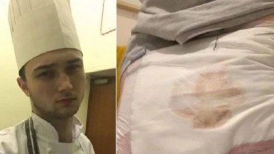 Nathan Davies teve as nádegas queimadas em 'brincadeira' em hotel (Foto: Reprodução)