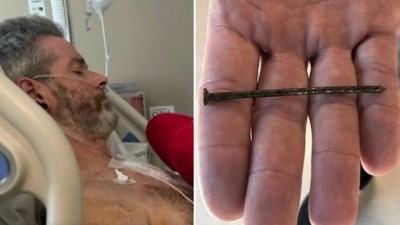 Aaron após cirurgia em hospital no Texas - Foto: Reprodução/KSWO; Twitter