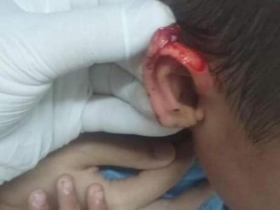 Inicialmente, mãe foi informada que filho foi mordido, mas ferimentos não são compatíveis (Foto/Reprodução)