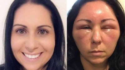 Julie antes e depois da aplicação da tintura de cabelo - Foto: Reprodução