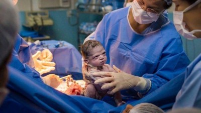 Foto de bebê 'zangada' viralizou nas redes sociais - Foto: Rodrigo Kunstmann