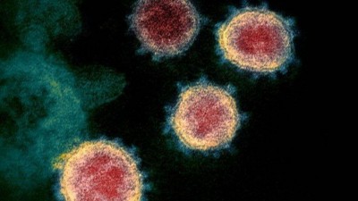 Imagem de microscópio eletrônico colorizada artificialmente mostra unidades de coronavírus emergindo de célula de paciente infectado nos EUA (Foto: NIAID/RML/NIH)