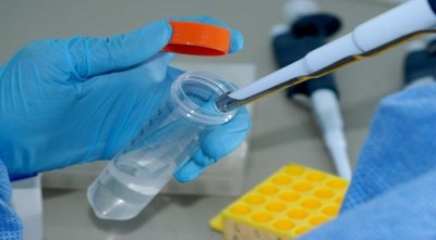 Com três novos casos, chega a 100 a quantidade de pessoas com coronavírus em MS