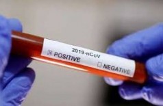 Dourados confirma mais um caso do novo coronavírus; total sobe para 11