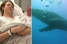 Alicia Ramsey foi 'atropelada' por baleia-jubarte - Foto: Reproduçção/Channel 9