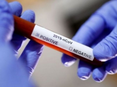 Boletim epidemiológico confirma 103ª morte por covid-19 em Dourados