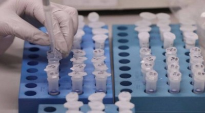 Dourados tem acréscimo de 57 casos de covid-19