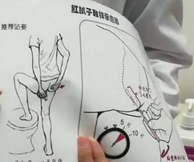 Exame anal para detecção do coronavírus na ChinaExame anal para detecção do coronavírus na China (Foto: Reprodução)