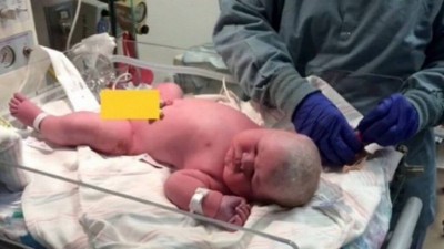 Bebê nasce com 6,5 quilos - Foto: Reprodução/TikTok