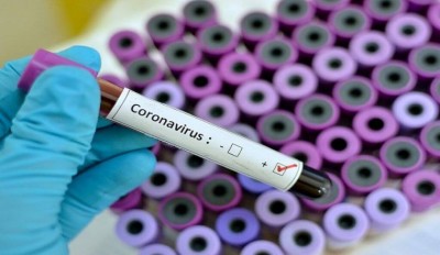 Nas 24 horas recentes houve 25 diagnósticos de Covid-19 no município e o total de confirmações chegou a 37.149 (Foto: Divulgação)