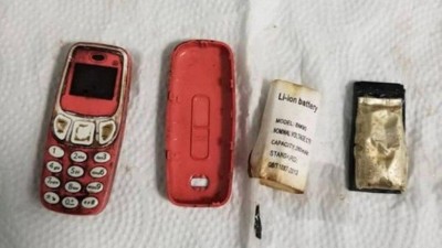 Homem passa por procedimento de emergência após engolir celular Nokia antigo - Foto: Reprodução/Facebook