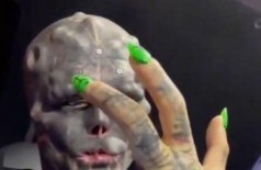 Anthony Loffredo teve dois dedos amputados para ficar mais parecido com 'alien' Foto: Reprodução/Instagram