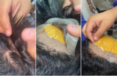 Suspeito foi preso com ouro escondido debaixo da peruca na Índia (Foto: Reprodução)