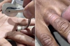 Joalheiro livra mulher de três anéis usados por 15 anos sem tirar (Foto: Reprodução/TikTok)
