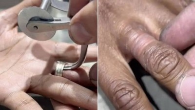 Joalheiro livra mulher de três anéis usados por 15 anos sem tirar (Foto: Reprodução/TikTok)
