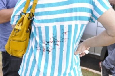 Mulher ficou com marcas de sangue após cortes causados por arame (Marcelo Calazans)
