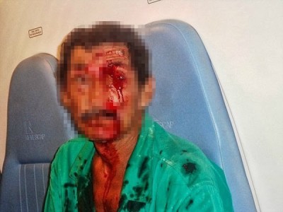 Adolescente de 13 anos esfaqueia padrasto na nuca após briga por bicho de estimação em MS