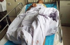 Na china, funcionário de asilo cortou testículos de 4 pacientes para comê-los