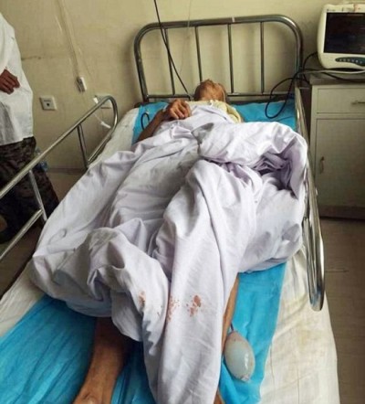 Na china, funcionário de asilo cortou testículos de 4 pacientes para comê-los