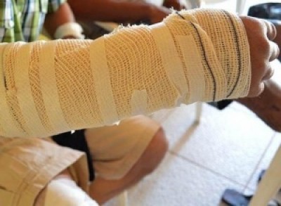 Vítimas receberam alta nesta manhã (Reprodução)