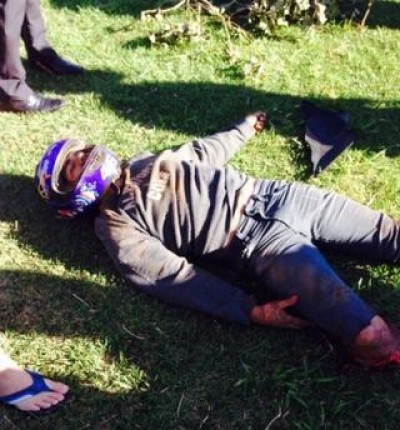 Imagens chocantes mostram momento em que motociclista amputa perna em acidente (assista)