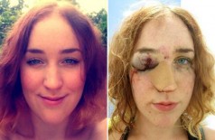 Mulher tira selfie após agressão e mostra o poder de uma imagem